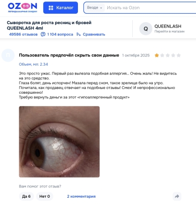 Queenlash отзывы: стоит ли рисковать зрением ради густых ресниц?