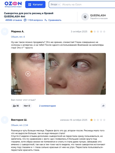 Queenlash отзывы: комедия красоты или опасный эксперимент?