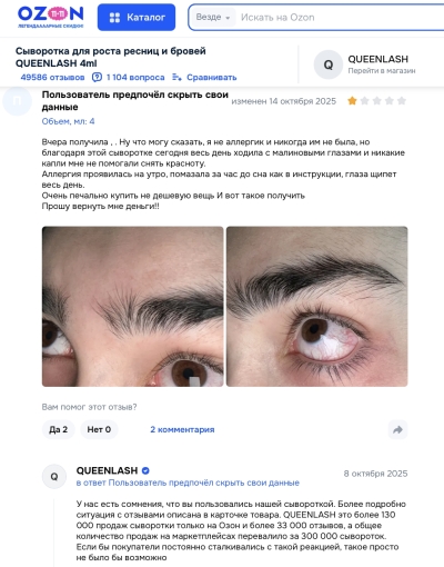Queenlash отзывы: Зачем рисковать глазами ради чудесных ресниц?